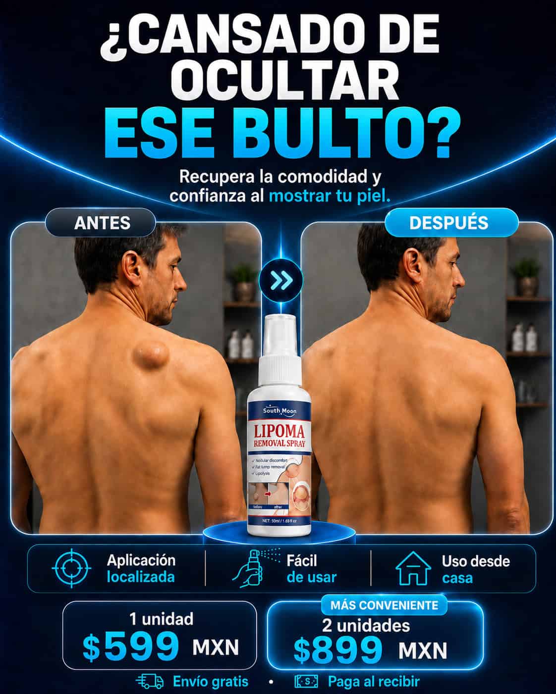 Spray Reductor de Lipomas|South Moon™