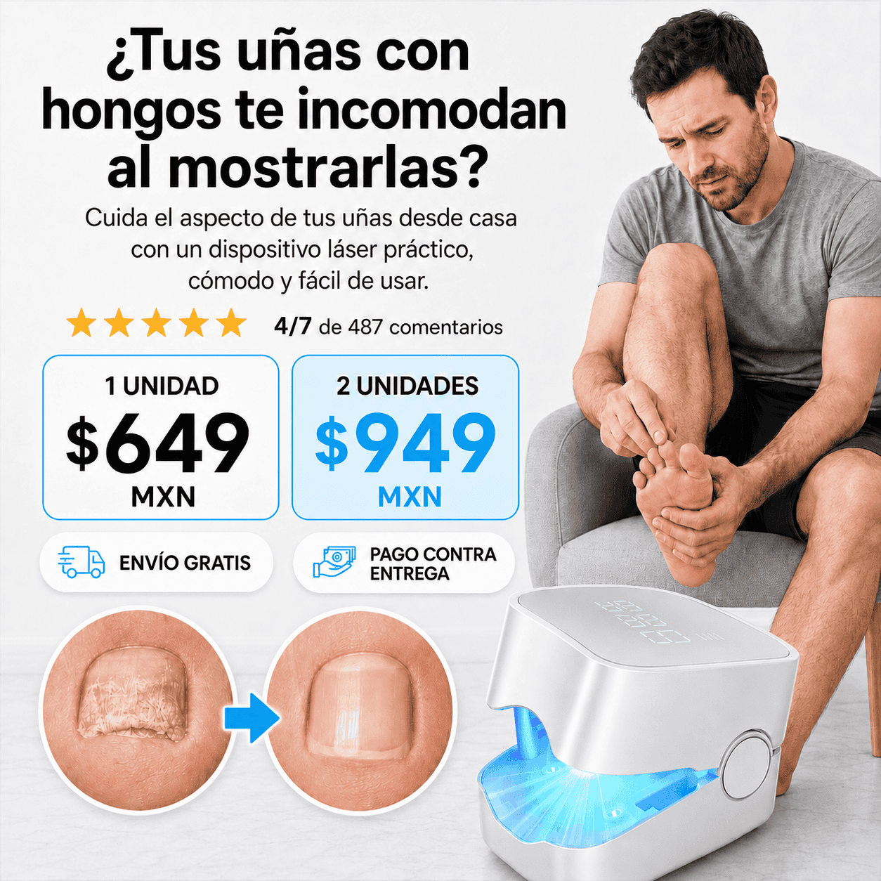 LaserNail™|Tecnología Antihongos para Uñas